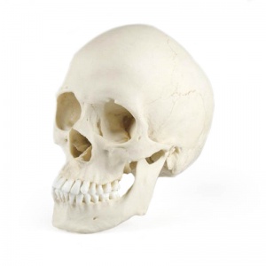 Scaphocephalic Model Skull